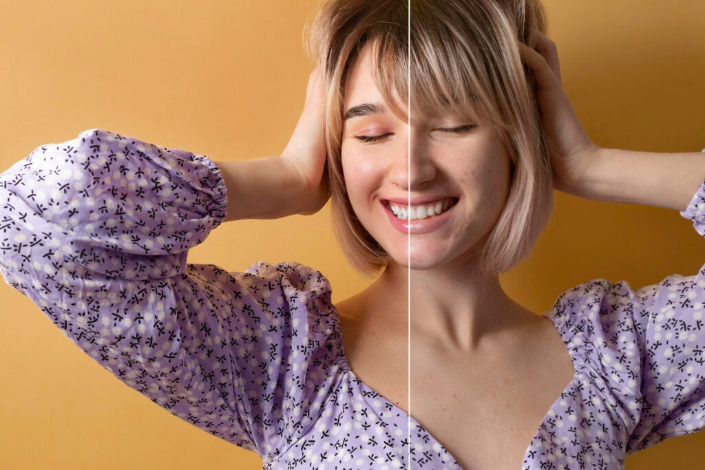 Elimina manchas en tu rostro y luce una piel uniforme
