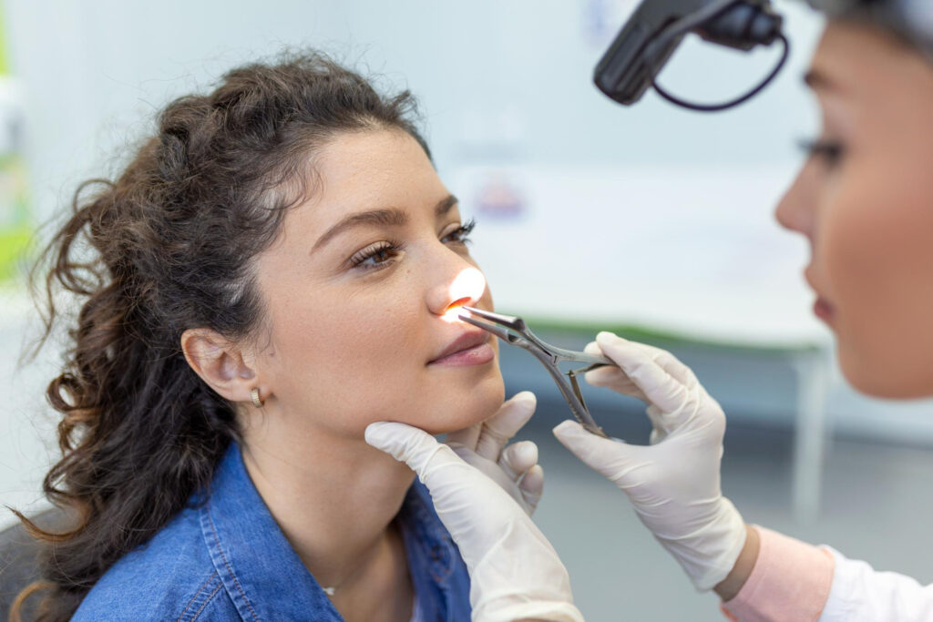 Resultados finales de una rinoplastia ¿cuánto tiempo tardan en verse
